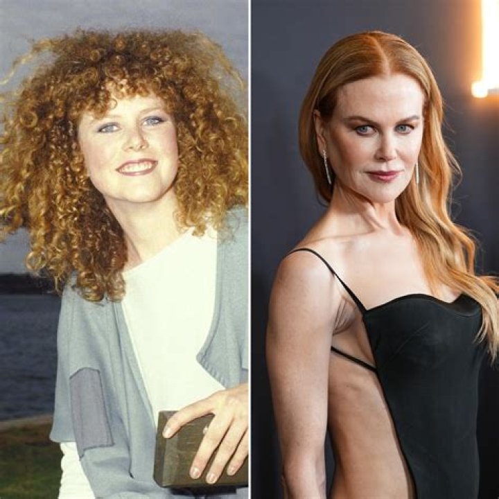 Nicole Kidman's Botox Saga: The Truth Unmasked