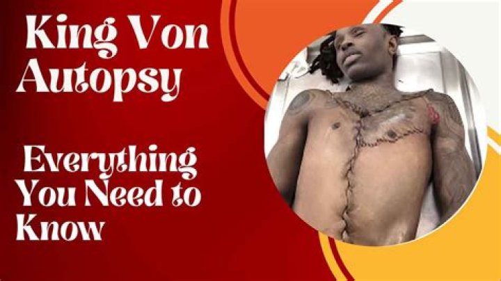 Startling Information: King Von Autopsy Photos Revealed