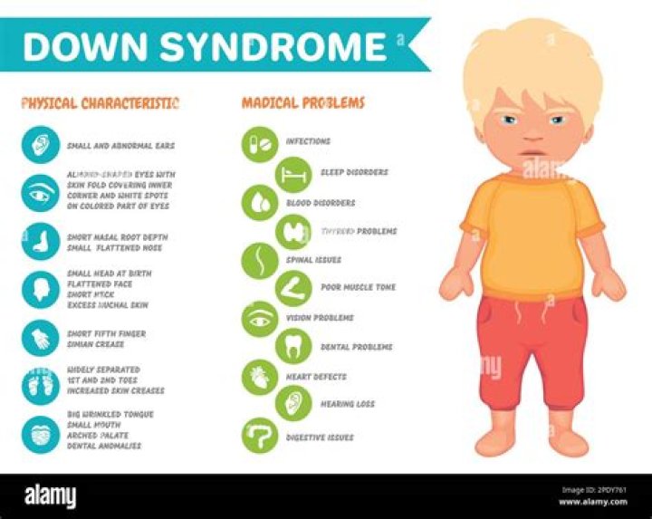 The Impact Of Down Syndrome On Eric Cowell's Life