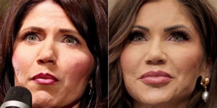 Ultimate Transformation: Kristi Noem's Unseen Before And After Photos
